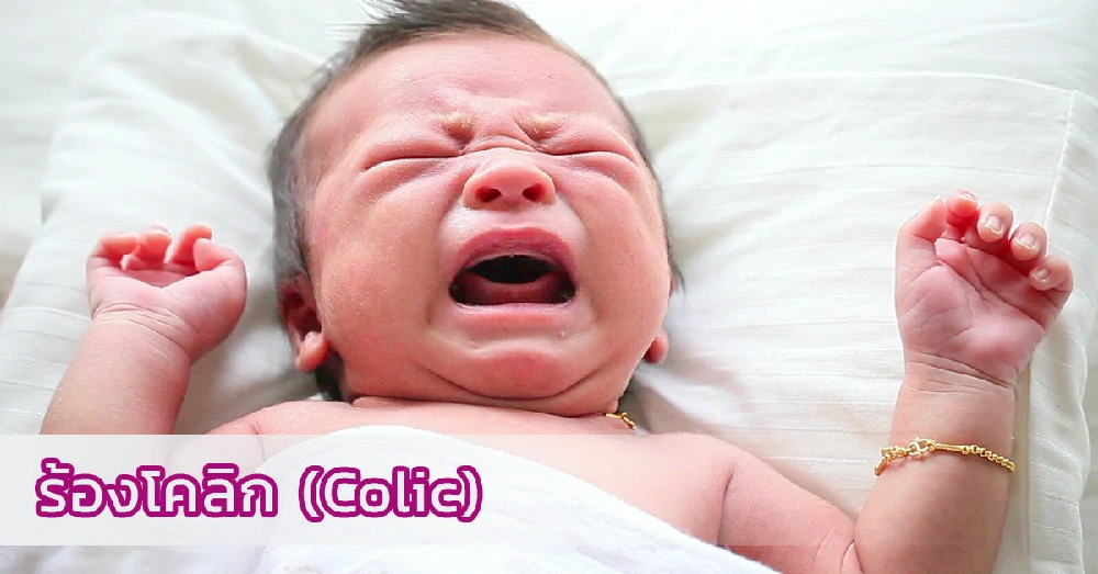 ร้องโคลิก (Colic)