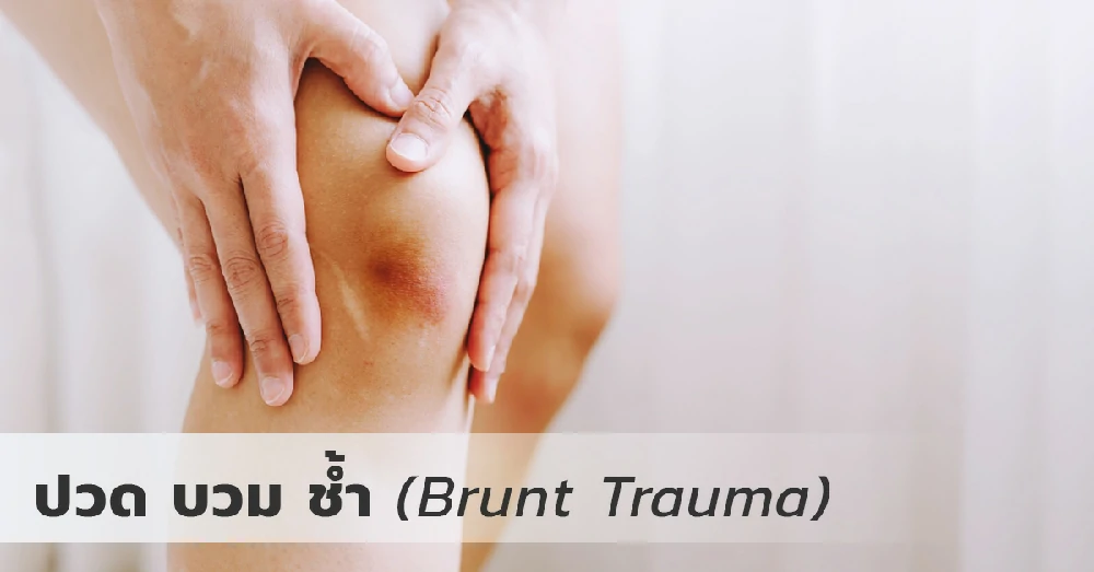 ปวด บวม ช้ำ (Brunt Trauma)