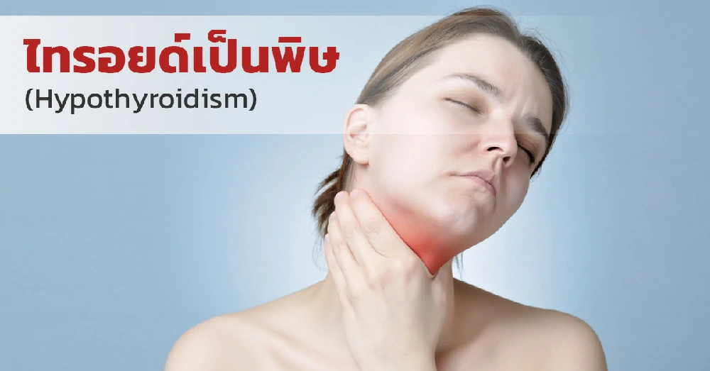 ไทรอยด์เป็นพิษ (Hypothyroidism)