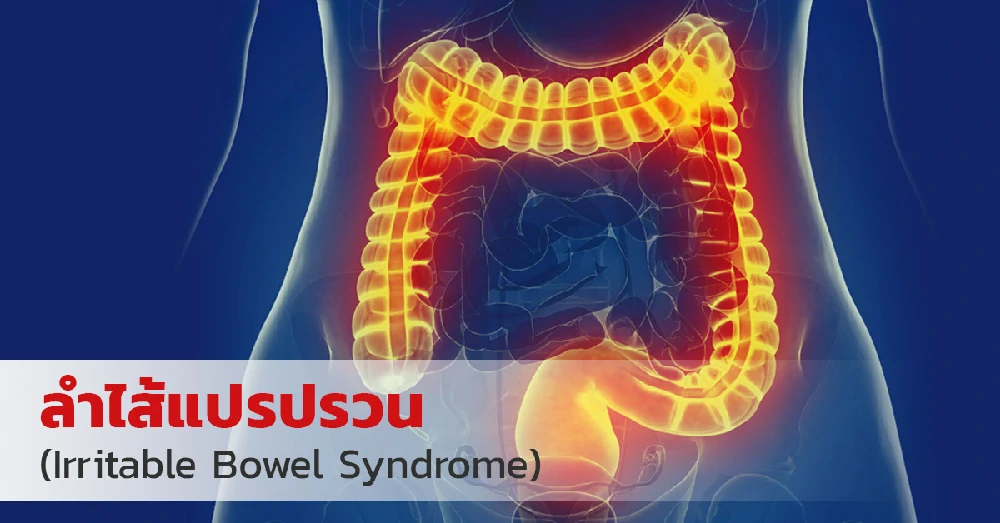 ลำไส้แปรปรวน (Irritable Bowel Syndrome)