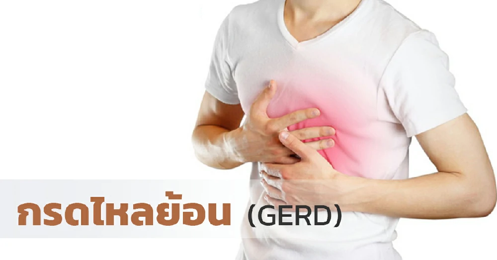 กรดไหลย้อน (GERD)