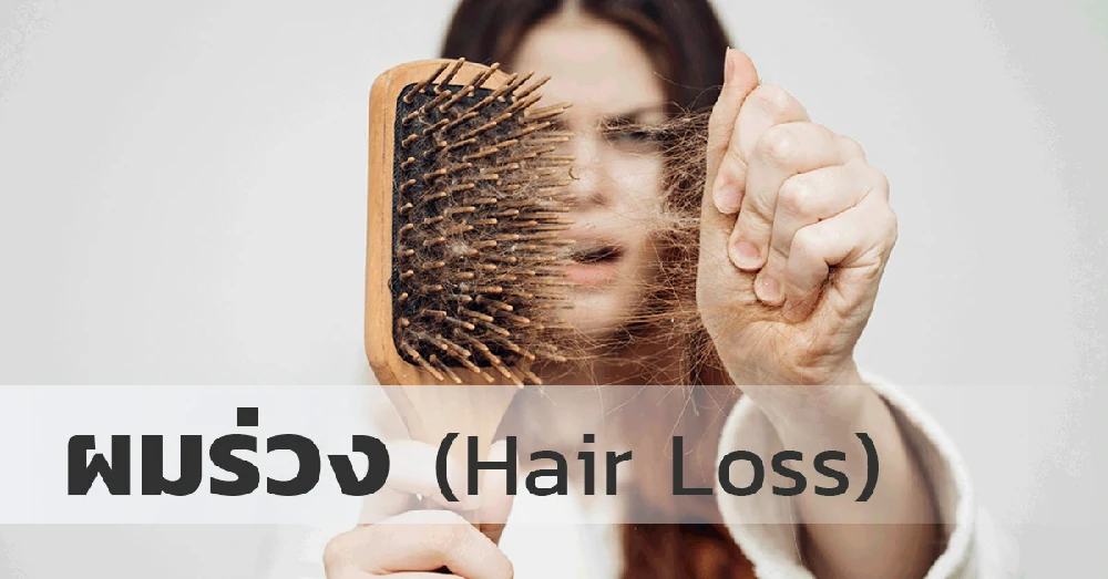 ผมร่วง (Hair Loss)