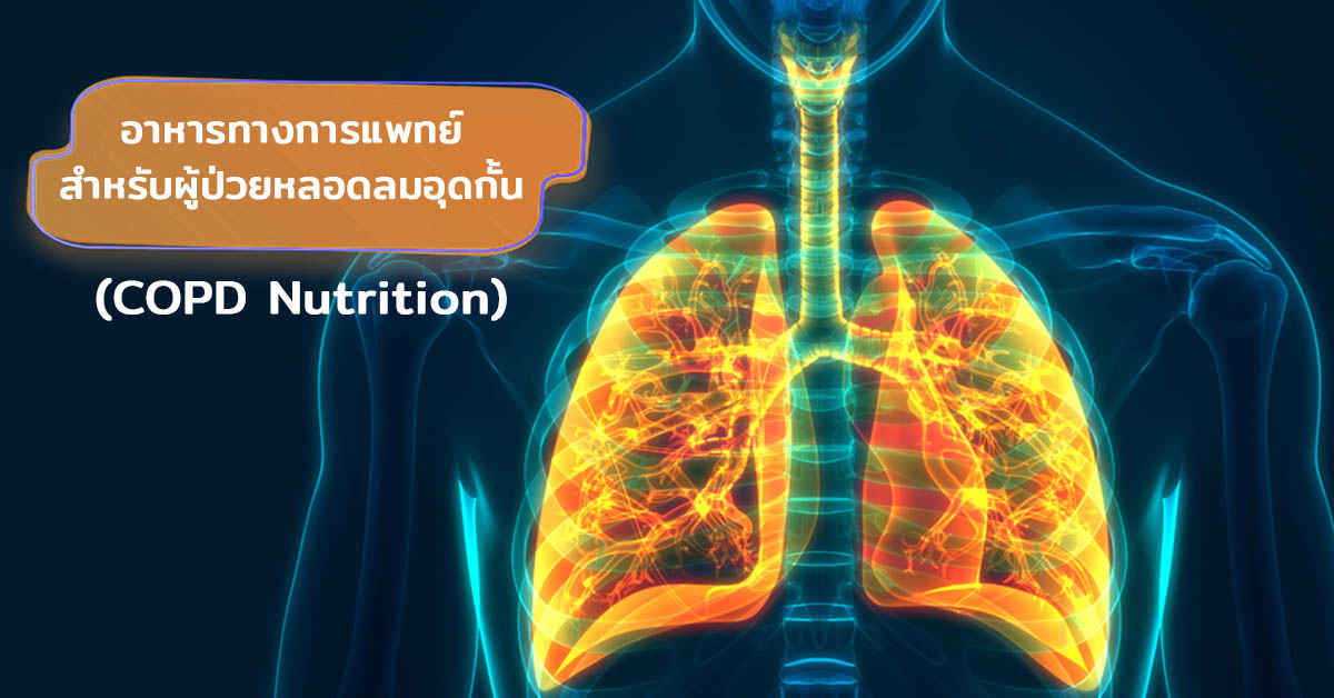 อาหารทางการแพทย์ สำหรับผู้ป่วยหลอดลมอุดกั้น (COPD Nutrition)