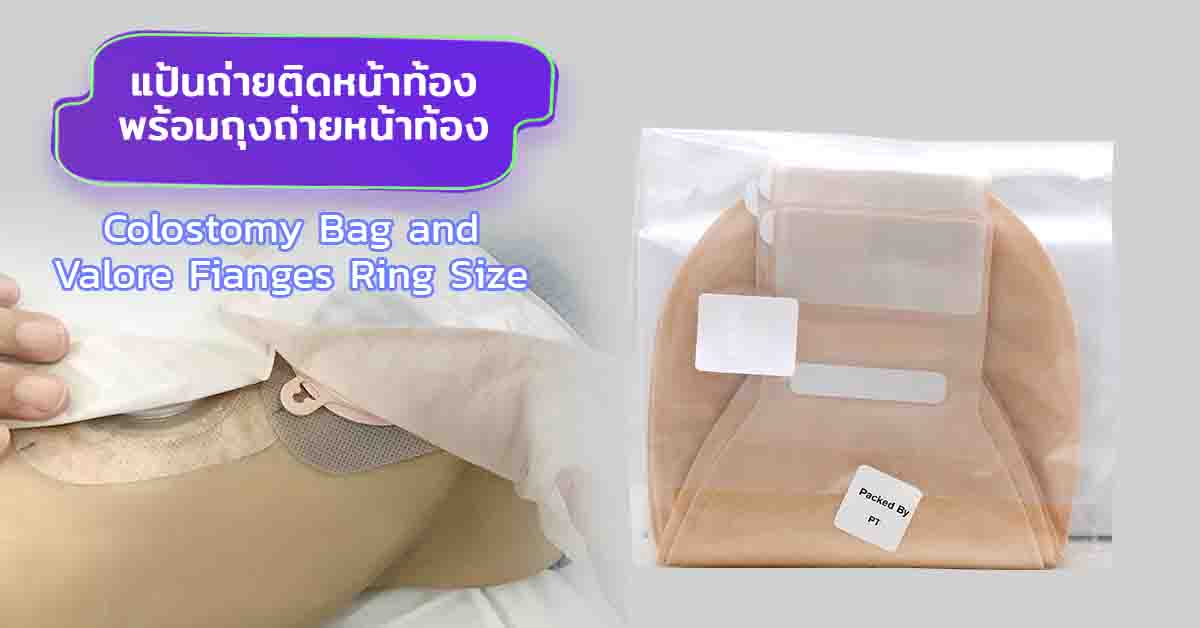 แป้นถ่ายติดหน้าท้อง พร้อมถุงถ่ายหน้าท้อง (Valore Fianges Ring Size)