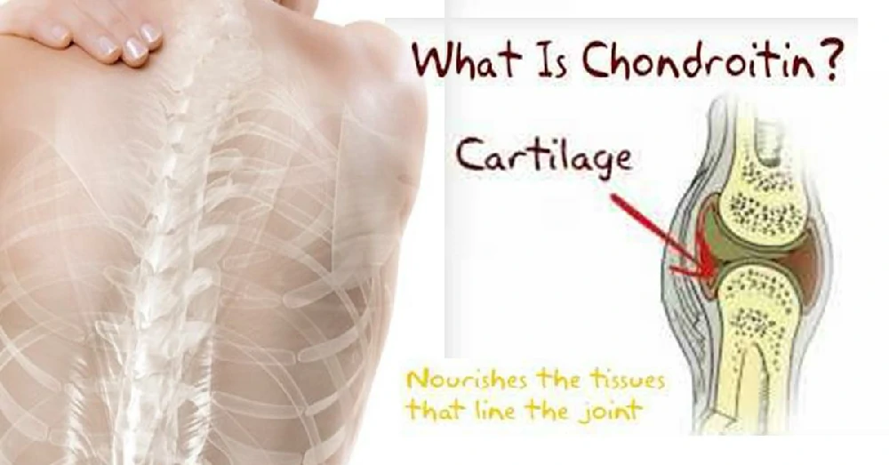 คอนโดรอิติน (Chondroitin)