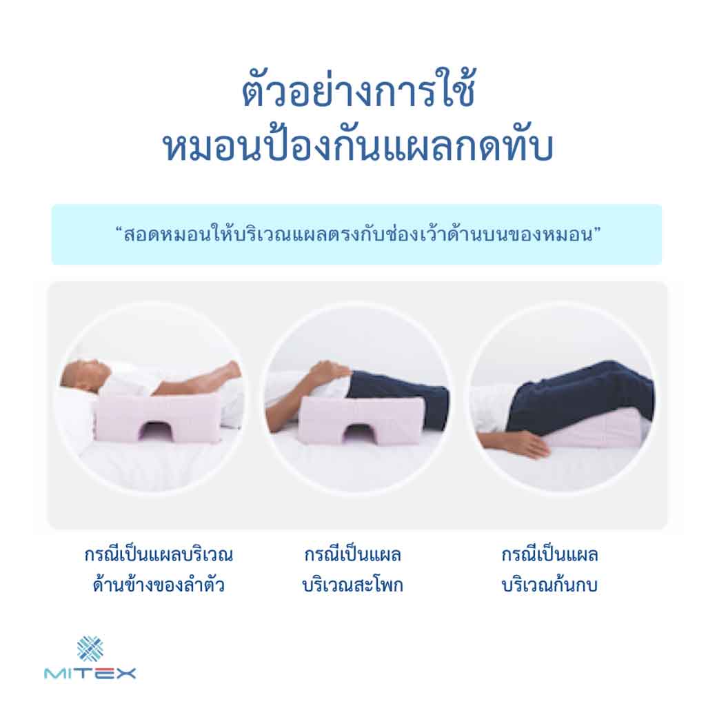 MITEX หมอนป้องกันแผลกดทับ (Anti-bedsore pillow) ไมเท็กซ์