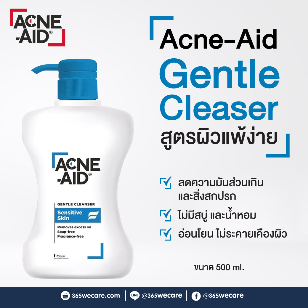 ACNE AID Gentle Cleanser 