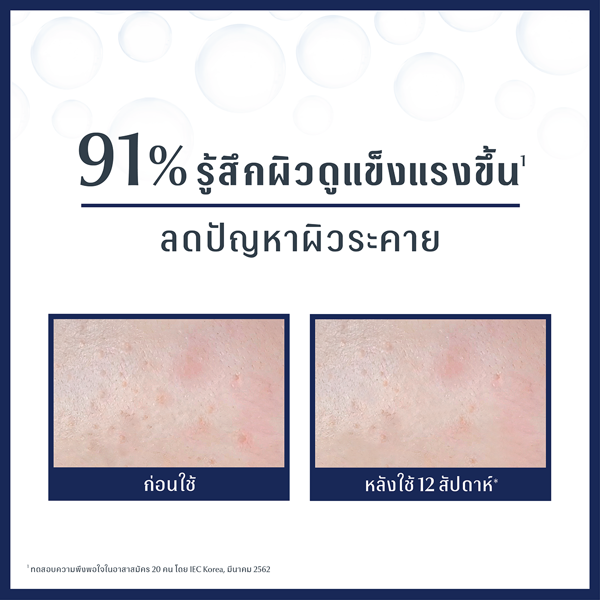 EUCERIN Ultra Sensitive Repair Gel Cream 50 ml. ยูเซอริน อัลตร้า เซนซิทีฟ รีแพร์ เจล ครีม 50มล.