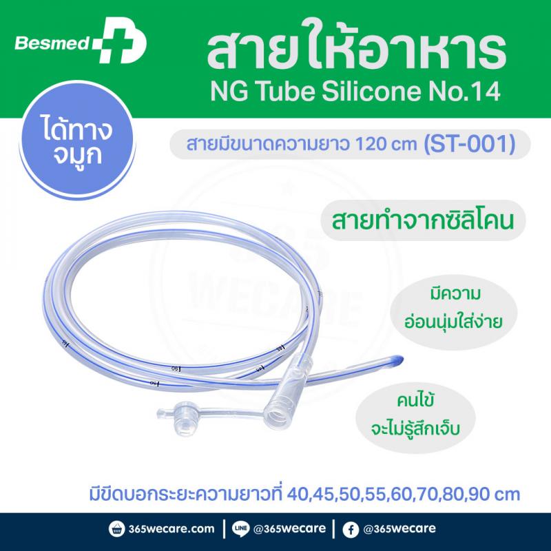 สายให้อาหาร NG Tube Silicone No.14(ST-001)(Taiwan)