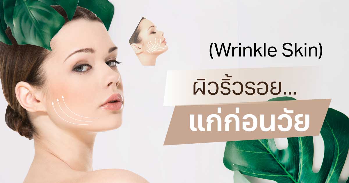 ผิวริ้วรอย..แก่ก่อนวัย (Wrinkle Skin)